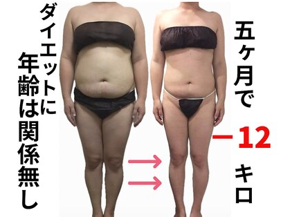リラ(Lilas)の写真