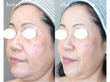 岩川治療院/５０代後半　女性のお客様