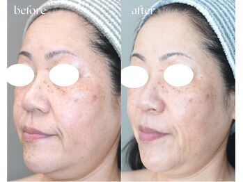 岩川治療院/50代後半 女性のお客様