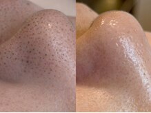 ウィズルーチェ 麻布十番店(with luce)/気になる毛穴へアプローチ