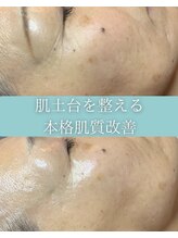 シェリール(cherir)&nbsp;肌に自信 がつく