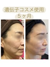 ビボーン ボディ(美bone body)/遺伝子コスメで肌質、たるみ改善