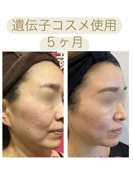ビボーン ボディ(美bone body)/遺伝子コスメで肌質、たるみ改善