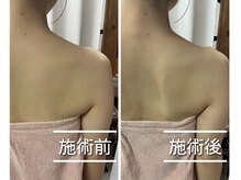 ファミリア整体院の雰囲気（肩こり肩甲骨はがし整体の症例実績【整体/肩こり/腰痛/千葉駅】）