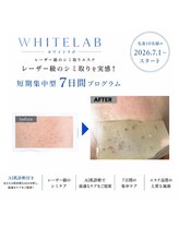 ウィズサロン(withサロン)&nbsp;シミケア 専門