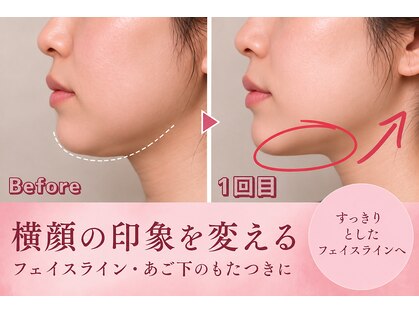 カンナムビューティー 新大久保店の写真