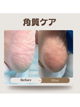 巻き爪補正店 那覇店/