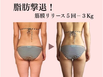 センジュ(senju)の写真