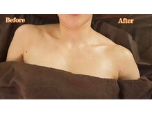 アイスパ 代官山(i-SPA)/上がった肩はしっかり下がります