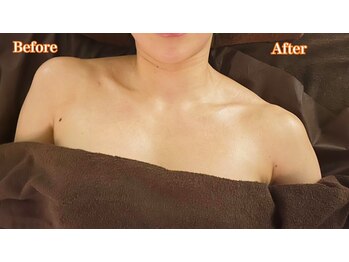 アイスパ 代官山(i-SPA)/上がった肩はしっかり下がります