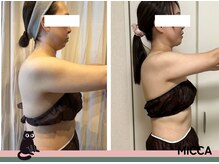 ヨサパーク ミッカ 学芸大学(YOSA PARK MiCCA.)/【水素まみれコース】11回１ヶ月