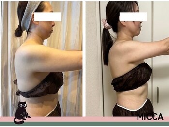 ヨサパーク ミッカ 学芸大学(YOSA PARK MiCCA.)/【水素まみれコース】11回1ヶ月