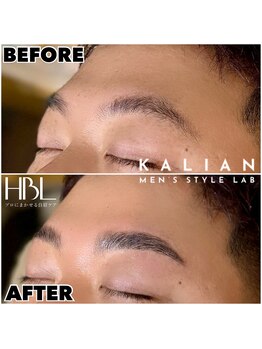 カリアン(KALIAN)/HBL＋高濃度トリートメント