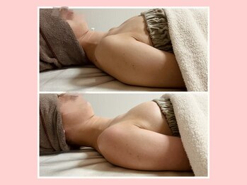 イッツソウ(It's so...)/ビフォーアフター写真