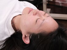 ヲタク専門もみほぐ鍼灸整体ヲタ健Lab.8の雰囲気（美容鍼は鍼だけじゃなく首・肩・頭・顔・脚の施術もついてます！）