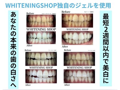 ホワイトニングショップ 豊川店の写真