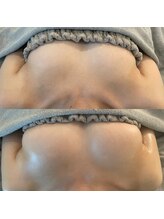 美人バスト 浦和店/【バストアップ★育乳】症例