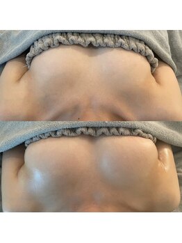 美人バスト 浦和店/【バストアップ★育乳】症例