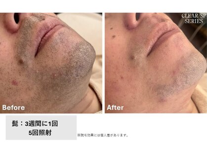スキンラボ(SKIN LABO)の写真