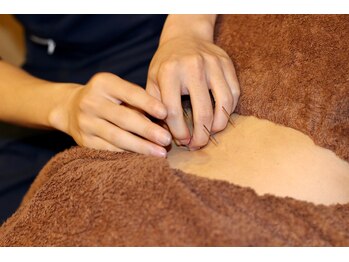 エスポアール(ESPOI'RE)/頑固な凝りにおすすめ!