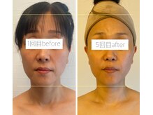 パル コルギサロン(Pal. Korugi salon)/コルギビフォーアフター