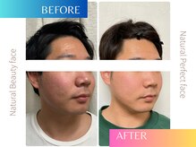 ナチュラルビューティーフェイス 横浜(NBF)/メンズ小顔矯正/むくみ改善/横浜
