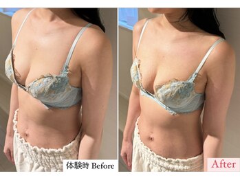 ラビス(RAVIS)/産後のバストもボリュームUP☆