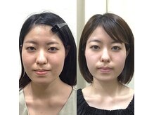シンメトリー栄の雰囲気（定期的にBA写真をお撮りします！結果出しにこだわるお店です）
