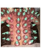 ウラヤス 恵比寿(Urayasu)/隙間なくカッピング筋膜リリース