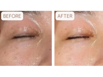 ブーケ/くすみ悩みにおすすめ！