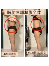 パラアモール(Paraamor)/ワンサイズダウンでスタイル爆群