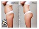 ストルツ(STOLZ)の写真