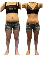 京都フォーエイチ(京都4H)/産後ケア4ヶ月の仕上がり