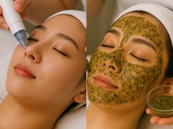 イース(ease)の写真/【徹底毛穴ケア！】ハーブピーリング/毛穴洗浄◎肌への負担を最小限に内側から輝く、潤い澄み渡る透明肌へ