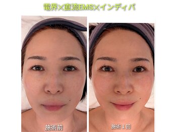 ザ スパ ゲンズブール/マトリクスウェーブ×インディバ