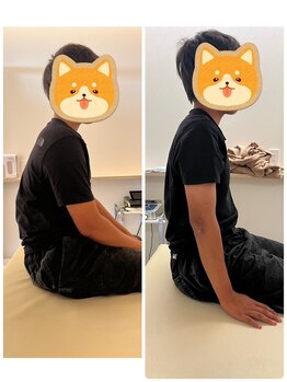 アキレア接骨院/姿勢改善