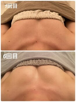 美人バスト 浦和店/【バストアップ★育乳】症例