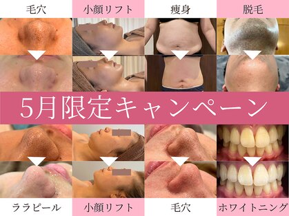 トワ 大宮(TOWA)の写真