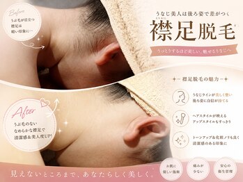 キラベル 平塚店(KiraBelle)/平塚/うなじ美肌ケア襟足脱毛