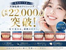 ホワイトベース(White Base)