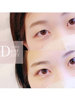 エールラッシュカール 森ノ宮(aile lash curl)/ダブルアイリフト、目の疲れに!