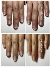 ネイルカフェ ナナ(nailcafe'nana)/自爪育成矯正