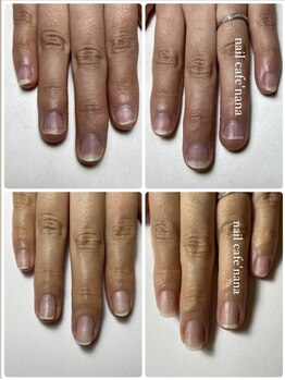 ネイルカフェ ナナ(nailcafe'nana)/自爪育成矯正