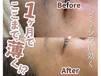 ウィンウィン 新山口店(Win Win)/コンプレックス解消