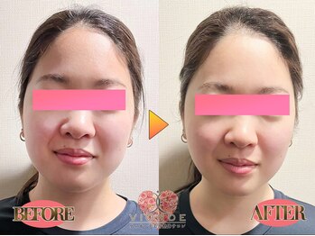 ヴィオーデ 銀座店/小顔、リンパ、ヘッドスパ、整体