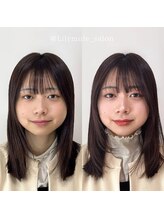 リリィミュール(LilyMule)/お客様 Before / After 