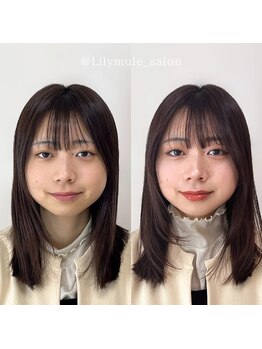 リリィミュール(LilyMule)/お客様 Before / After 