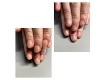 デジール(Desir)の雰囲気（深爪矯正ワンカラーコース。すぐに見た目が改善されます。）