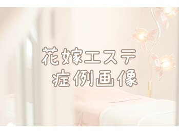 れふぇるん 足利店/花嫁エステ