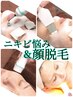 ☆最新マシン使用【ニキビ悩み&顔脱毛】こだわりの詰まったスペシャルケア♪